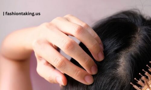 Are You Suffering From Thinning hair? Choose a hair system for women