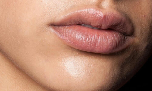 Lip Balms to Heal Your Dry Lips